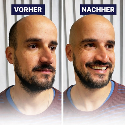 NOVA-SHAVE-360™